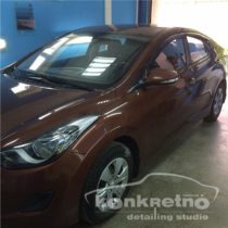 Hyundai Elantra без тонировки